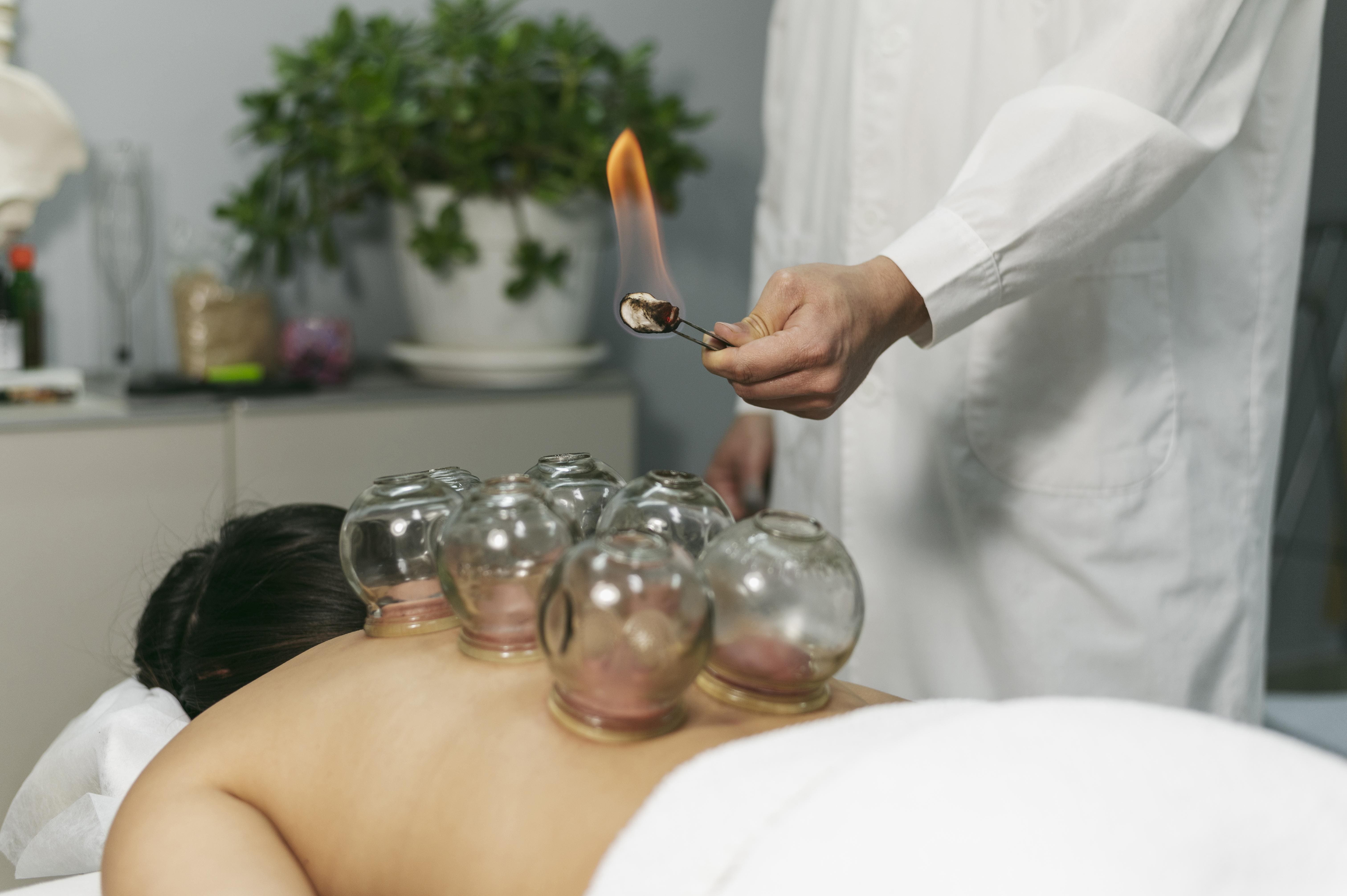 Terapia con Ventosas: Una Mirada Completa a esta Técnica Ancestral
