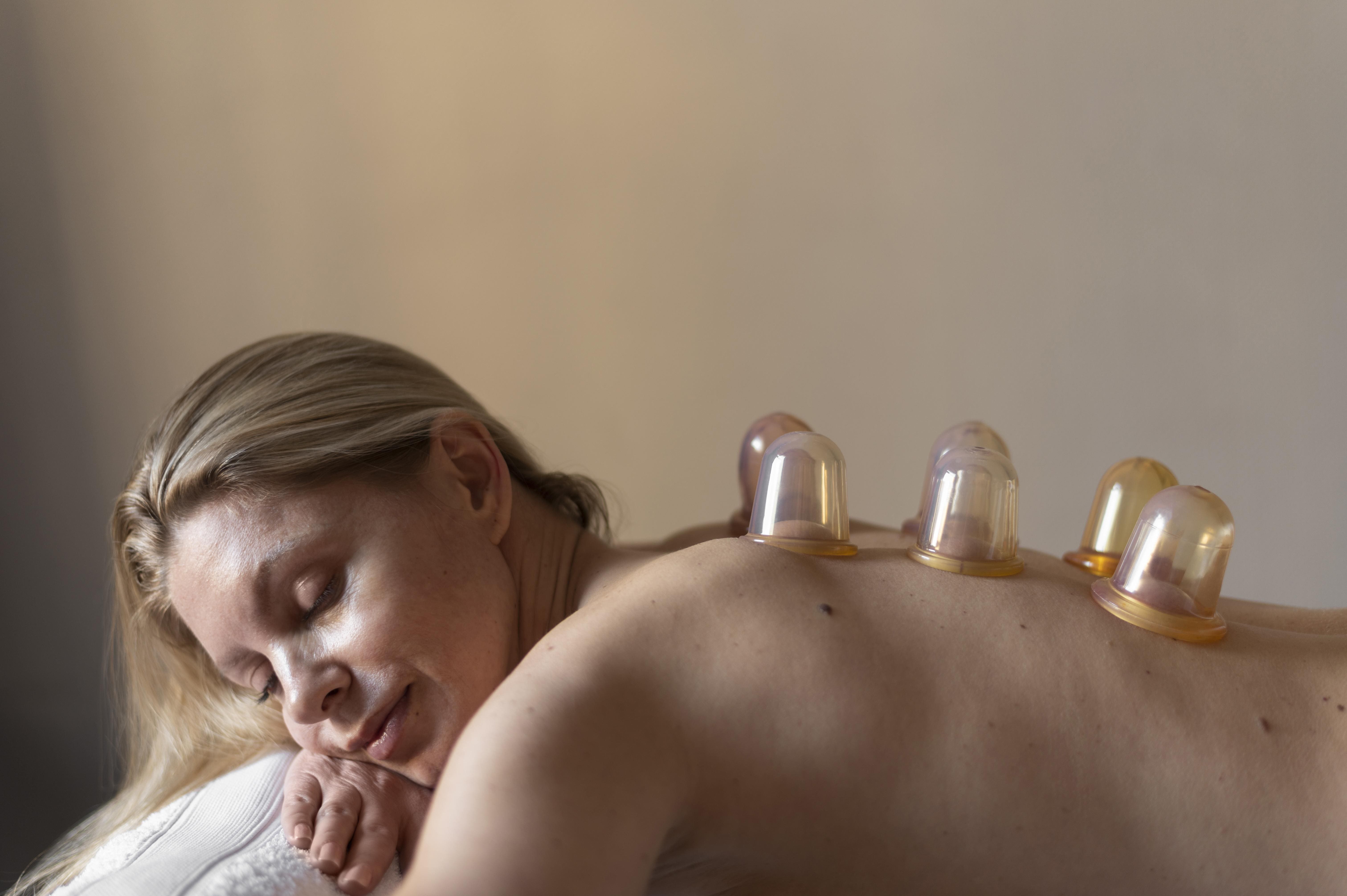 ¿Sabías que la Terapia con Ventosas Puede Ser la Clave para Transformar tu Bienestar Emocional y Femenino? Descubre Cómo Esta Técnica Ancestral Está Revolucionando el Tratamiento de la Depresión y los Problemas de Salud Femenina